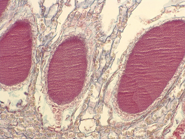 Liverwort Antheridia CS Slides - Liverwort Antheridia CS 02 200X